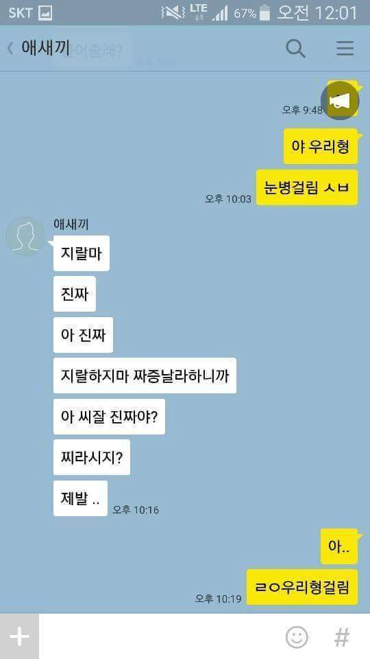 야 우리형 눈병 걸림.jpg