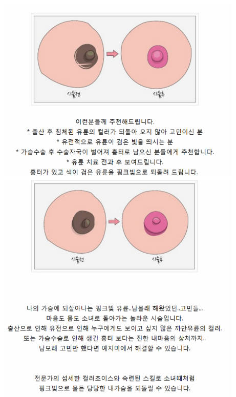 검두에서핑두.PNG