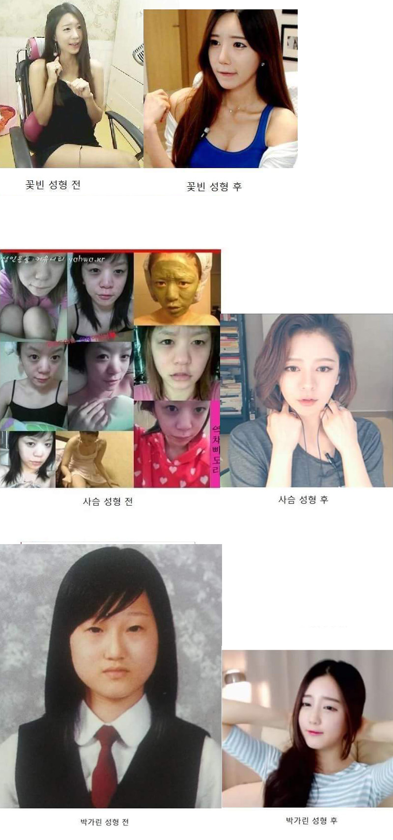 아프리카 bj 성형 전후.jpg